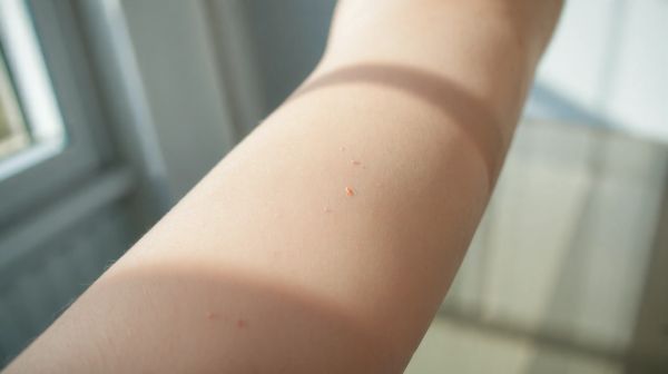 Pourquoi choisir l'épilation laser à Lyon pour éliminer la pilosité